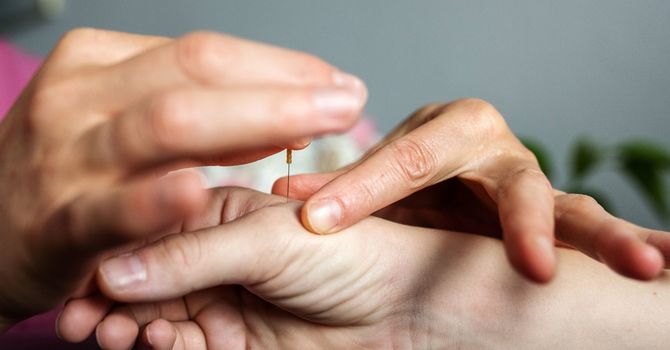 Medical Acupuncture
